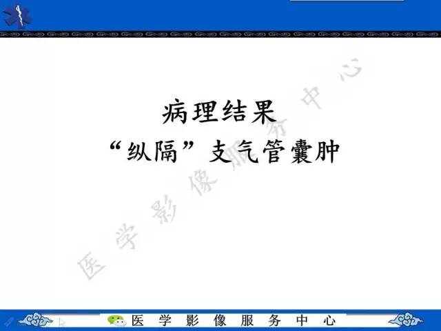 【病例】纵隔支气管囊肿1例CT影像表现