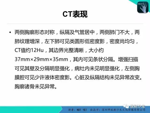 【病例】肺脓肿1例CT影像诊断与鉴别
