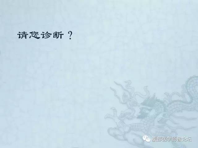 【病例】阑尾黏液囊腺癌1例CT影像表现