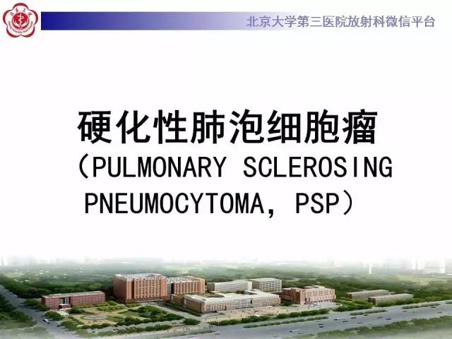 【病例】硬化性肺泡细胞瘤/肺硬化性血管瘤1例CT