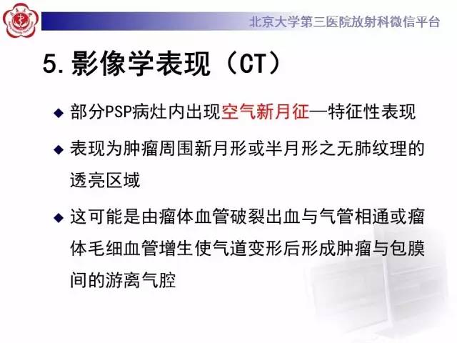 【病例】硬化性肺泡细胞瘤/肺硬化性血管瘤1例CT