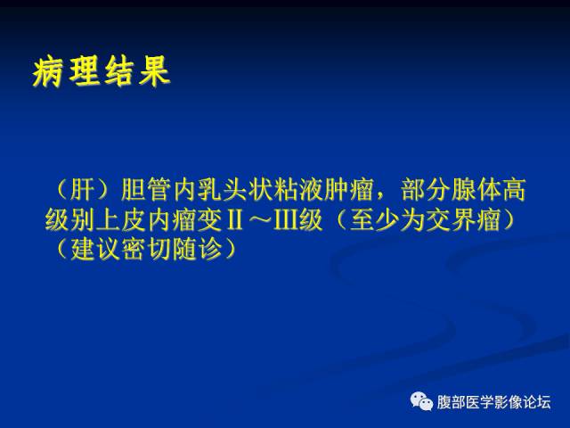 【病例】肝内胆管内乳头状粘液肿瘤1例CT