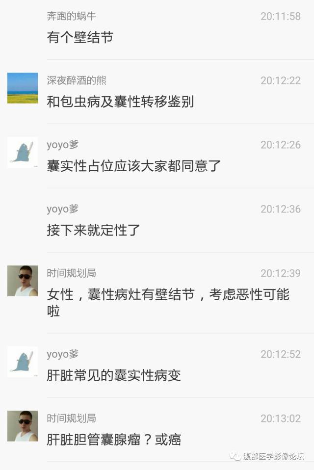【病例】肝内胆管内乳头状粘液肿瘤1例CT