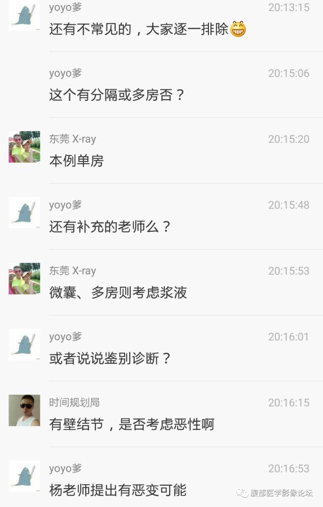 【病例】肝内胆管内乳头状粘液肿瘤1例CT