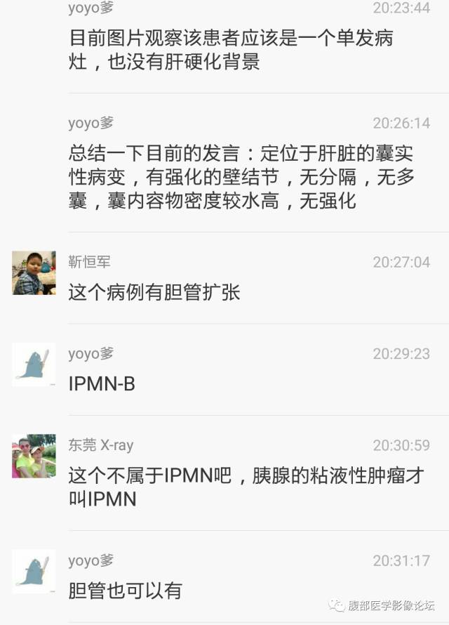 【病例】肝内胆管内乳头状粘液肿瘤1例CT