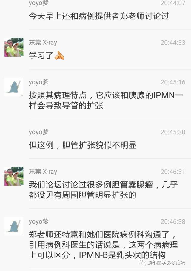 【病例】肝内胆管内乳头状粘液肿瘤1例CT