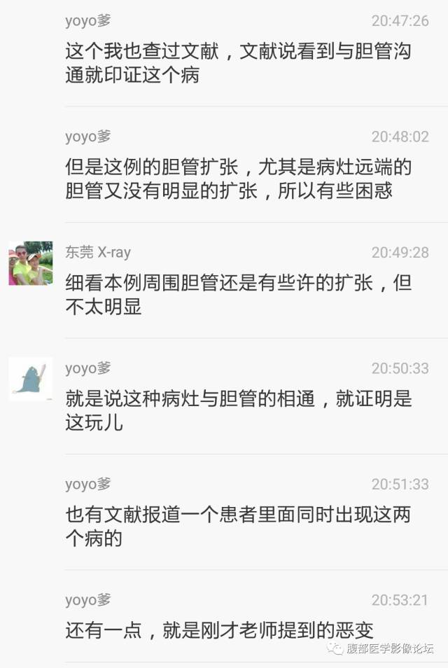 【病例】肝内胆管内乳头状粘液肿瘤1例CT