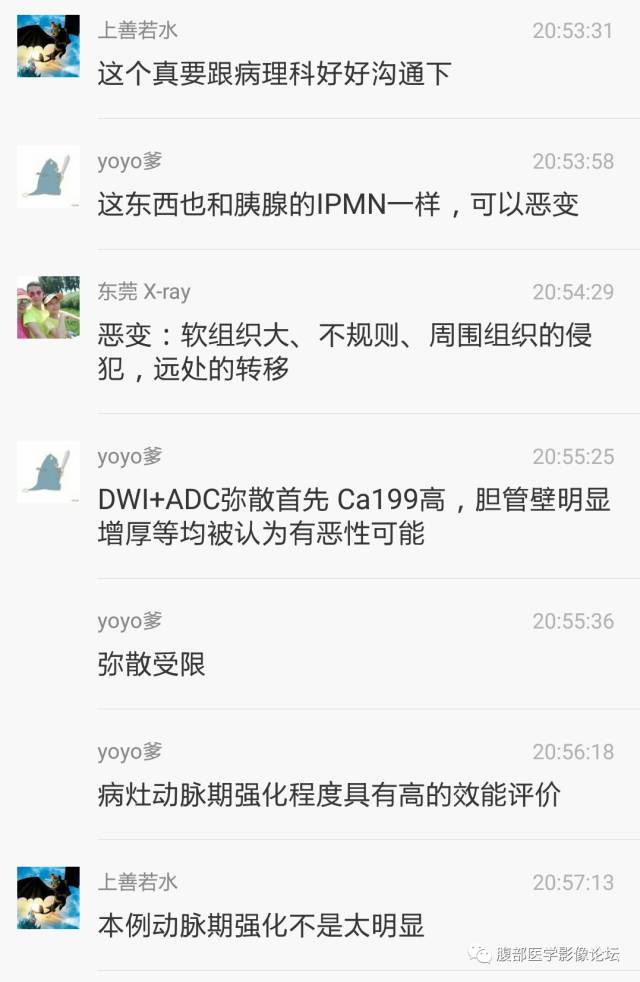 【病例】肝内胆管内乳头状粘液肿瘤1例CT