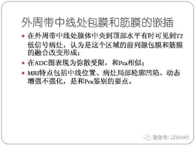 【PPT】前列腺周围带扩散受限的良性病变：诊断与鉴别诊断