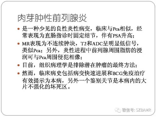 【PPT】前列腺周围带扩散受限的良性病变：诊断与鉴别诊断