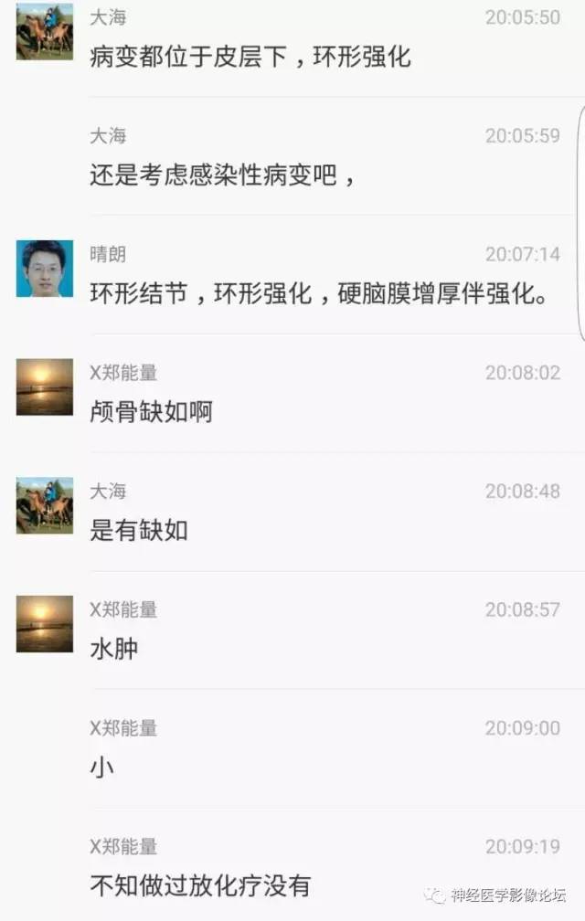 【病例】脑囊虫病1例MR影像表现