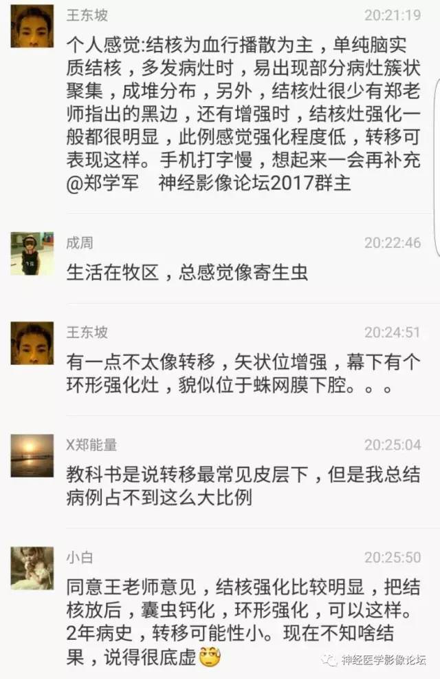 【病例】脑囊虫病1例MR影像表现