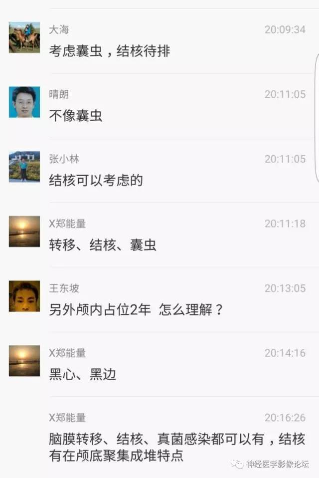 【病例】脑囊虫病1例MR影像表现