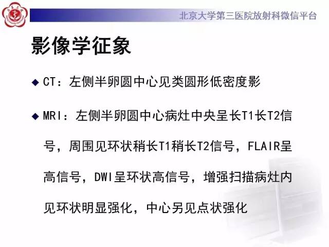 【病例】同心圆硬化1例CT及MR影像表现