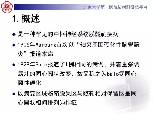 【病例】同心圆硬化1例CT及MR影像表现