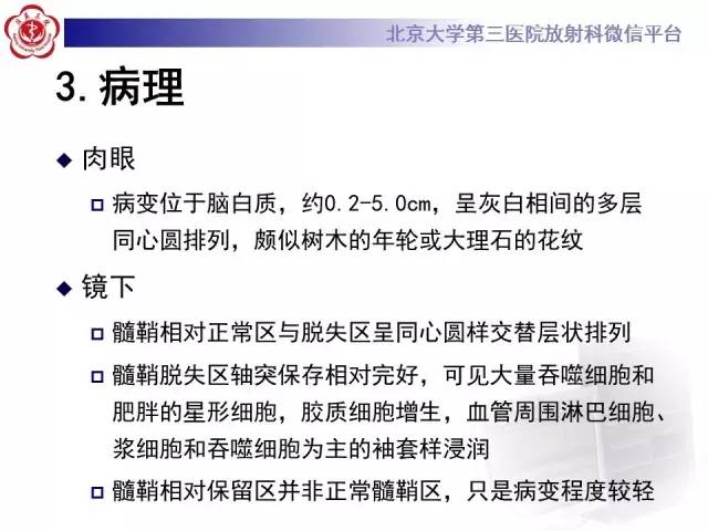 【病例】同心圆硬化1例CT及MR影像表现