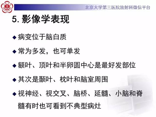 【病例】同心圆硬化1例CT及MR影像表现