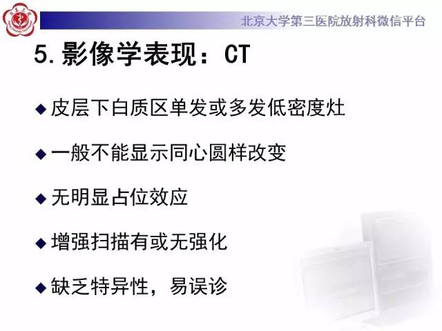 【病例】同心圆硬化1例CT及MR影像表现