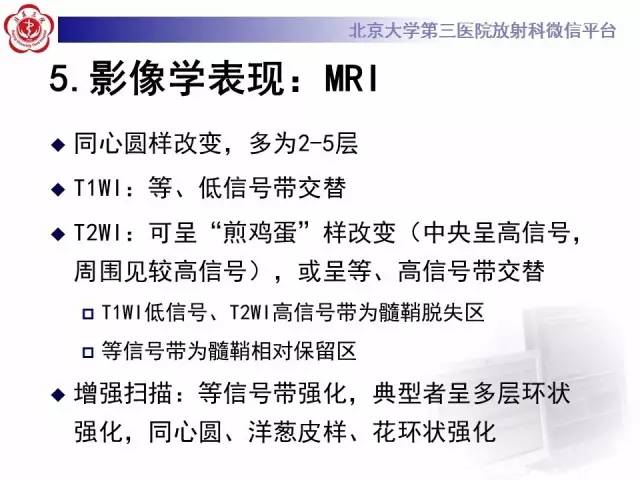 【病例】同心圆硬化1例CT及MR影像表现