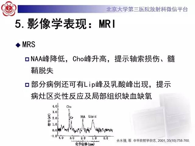 【病例】同心圆硬化1例CT及MR影像表现
