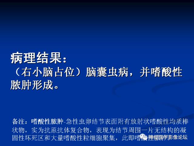 【病例】右小脑囊虫病一例MR