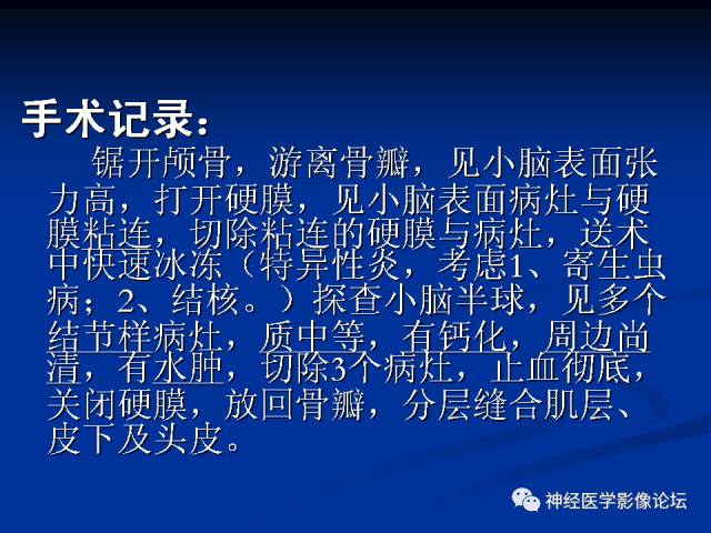 【病例】右小脑囊虫病一例MR