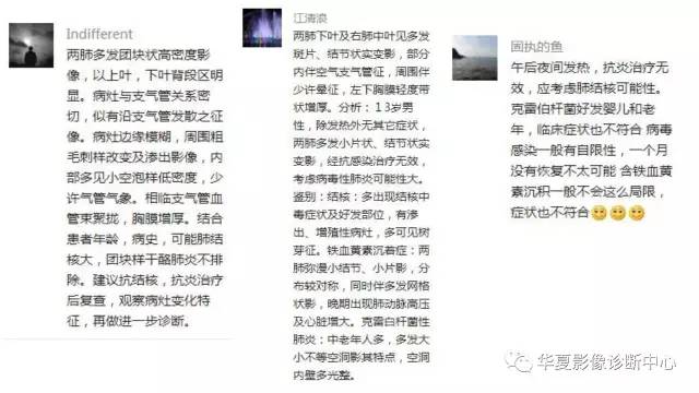 【病例】不典型的肺含铁血黄素沉积症1例CT