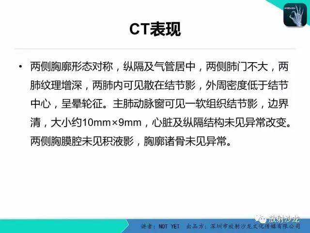 【病例】真菌性肺炎1例CT影像表现