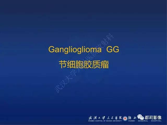 【PPT】节细胞胶质瘤影像诊断