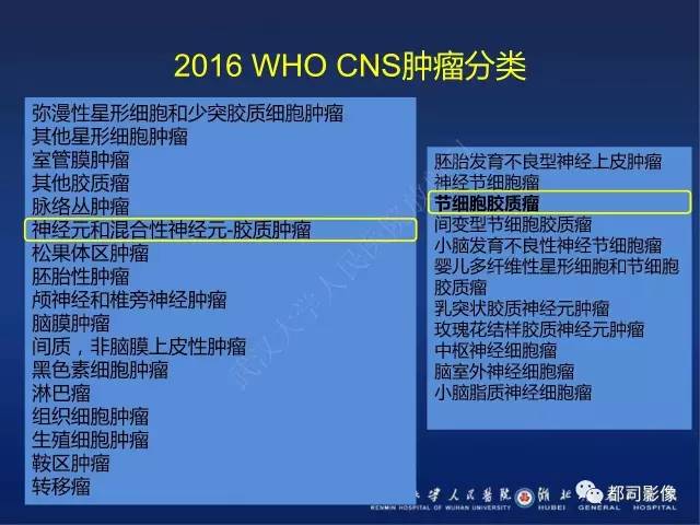 【PPT】节细胞胶质瘤影像诊断