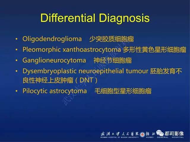 【PPT】节细胞胶质瘤影像诊断