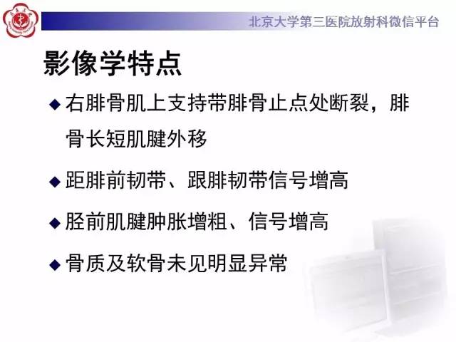 【病例】腓骨肌腱脱位1例MR