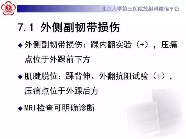 【病例】腓骨肌腱脱位1例MR