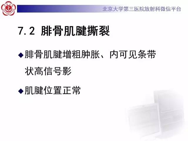 【病例】腓骨肌腱脱位1例MR