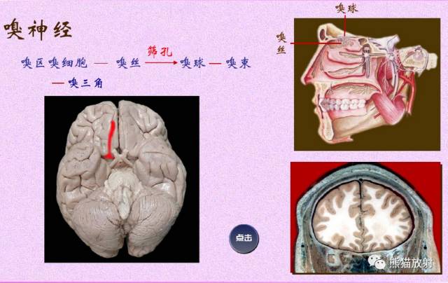 脑神经MRI断层解剖 脑神经MRI断层解剖