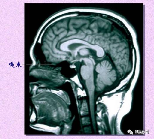 脑神经MRI断层解剖 脑神经MRI断层解剖