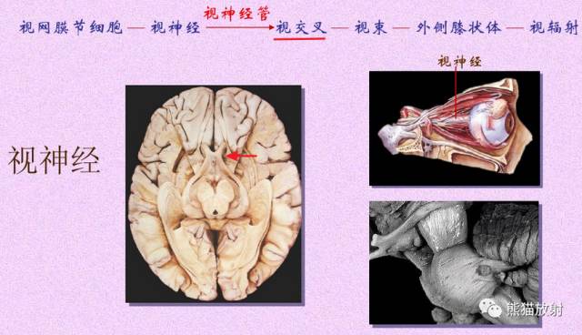 脑神经MRI断层解剖 脑神经MRI断层解剖