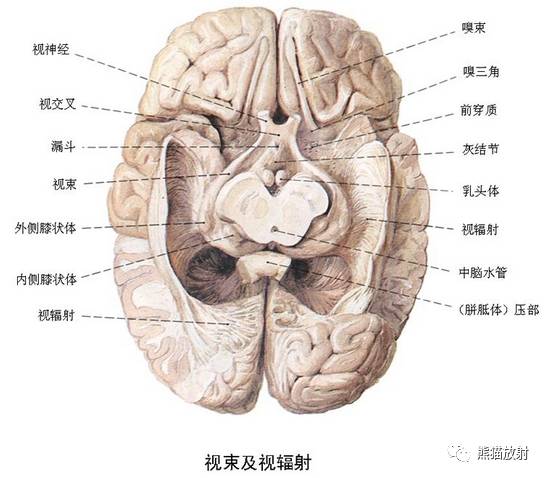 脑神经MRI断层解剖 脑神经MRI断层解剖