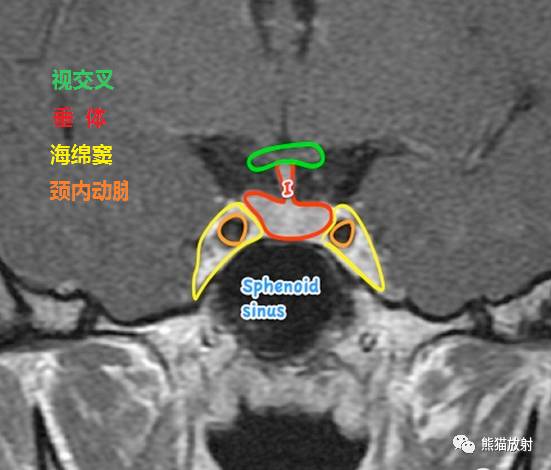 脑神经MRI断层解剖 脑神经MRI断层解剖
