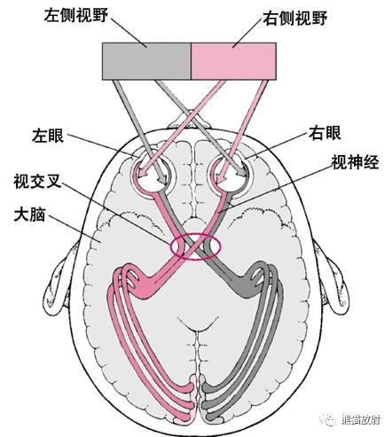 脑神经MRI断层解剖 脑神经MRI断层解剖