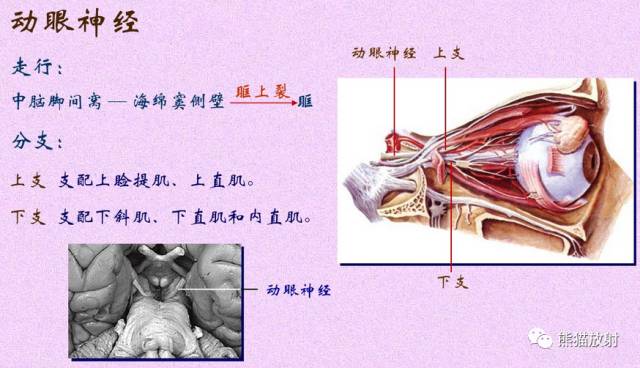 脑神经MRI断层解剖 脑神经MRI断层解剖