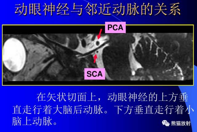 脑神经MRI断层解剖 脑神经MRI断层解剖