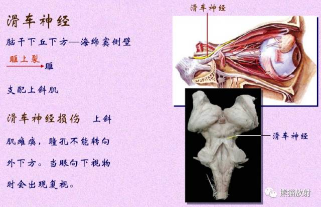 脑神经MRI断层解剖 脑神经MRI断层解剖