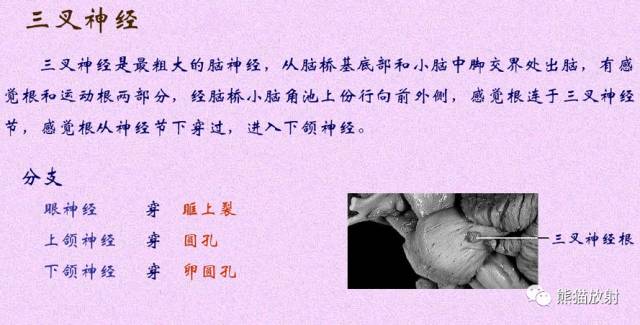 脑神经MRI断层解剖 脑神经MRI断层解剖