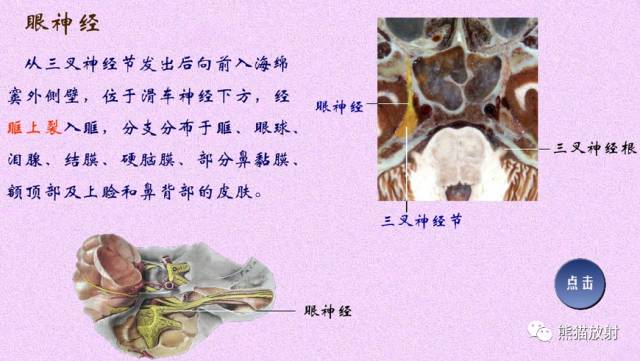 脑神经MRI断层解剖 脑神经MRI断层解剖