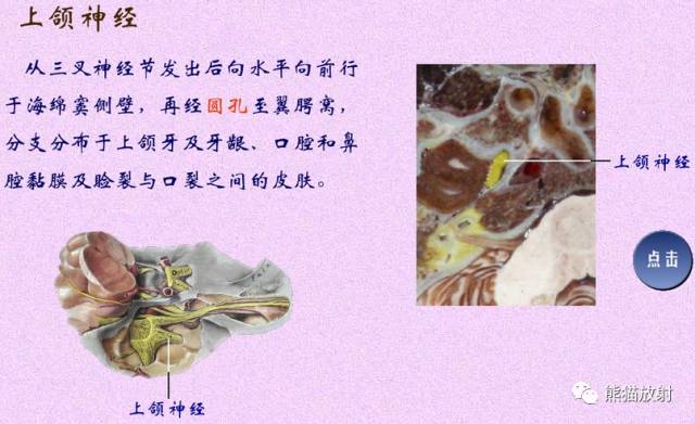 脑神经MRI断层解剖 脑神经MRI断层解剖
