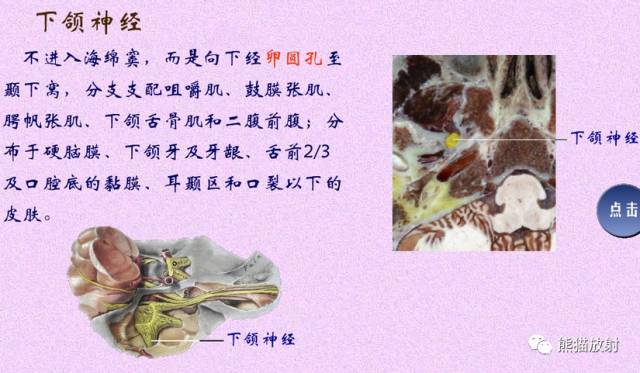 脑神经MRI断层解剖 脑神经MRI断层解剖