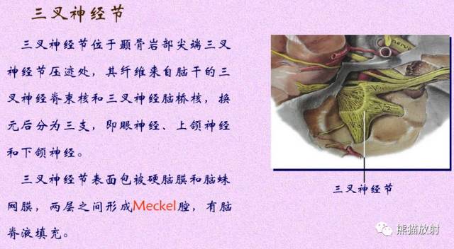 脑神经MRI断层解剖 脑神经MRI断层解剖