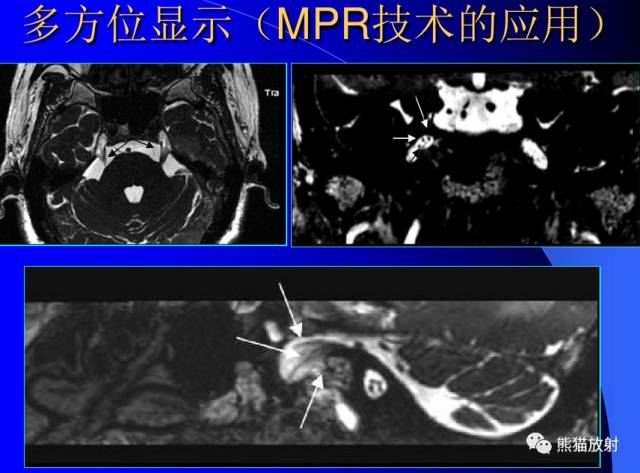 脑神经MRI断层解剖 脑神经MRI断层解剖