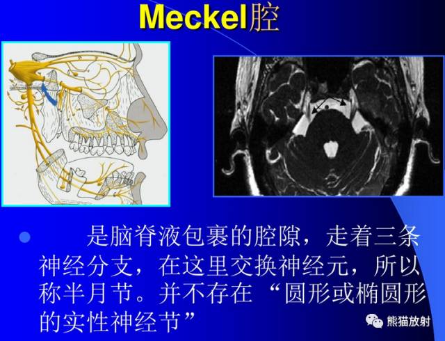 脑神经MRI断层解剖 脑神经MRI断层解剖